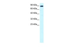Aviva Systems Biology Corp KIF21A Antibody - N-terminal region (ARP33932_P050)