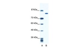 Aviva Systems Biology Corp KIF23 Antibody - N-terminal region (ARP33962_P050)