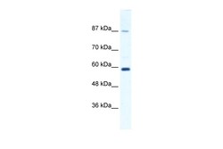 Aviva Systems Biology Corp KIF23 Antibody - N-terminal region (ARP33963_T100)