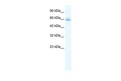 Aviva Systems Biology Corp CBFA2T3 Antibody - N-terminal region (ARP33993_P050)