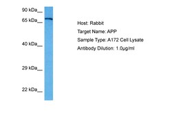 Aviva Systems Biology Corp APP Antibody - middle region (ARP34012_P050)