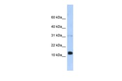 Aviva Systems Biology Corp REG1B Antibody - N-terminal region (ARP34029_P050)