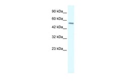 Aviva Systems Biology Corp RGS6 Antibody - C-terminal region (ARP34043_P050)