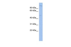 Aviva Systems Biology Corp PTGER3 Antibody - middle region (ARP34098_P050)