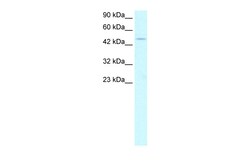 Aviva Systems Biology Corp PPARA Antibody - middle region (ARP34113_T100)