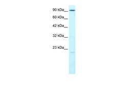 Aviva Systems Biology Corp LIG4 Antibody - N-terminal region (ARP34122_T100)
