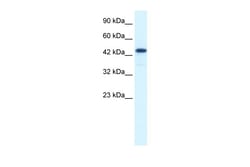 Aviva Systems Biology Corp RCOR3 Antibody - N-terminal region (ARP34132_T100)