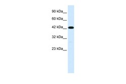 Aviva Systems Biology Corp C19ORF6 Antibody - middle region (ARP34137_T100)