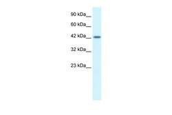 Aviva Systems Biology Corp ATF2 Antibody - C-terminal region (ARP34151_T100)