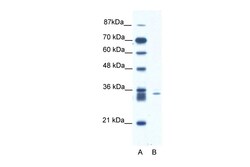 Aviva Systems Biology Corp SIAH1 Antibody - N-terminal region (ARP34163_T100)