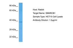 Aviva Systems Biology Corp SMARCB1 Antibody - middle region (ARP34172_P050)