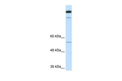 Aviva Systems Biology Corp TIMELESS Antibody - N-terminal region (ARP34186_P050)