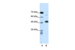Aviva Systems Biology Corp COPS2 Antibody - N-terminal region (ARP34189_P050)
