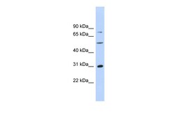 Aviva Systems Biology Corp ASPH Antibody - middle region (ARP34194_P050)