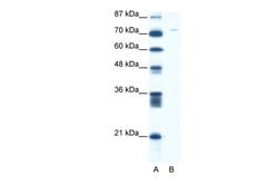 Aviva Systems Biology Corp ASPH Antibody - middle region (ARP34195_T100)