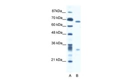 Aviva Systems Biology Corp ASH2L Antibody - N-terminal region (ARP34203_T100)