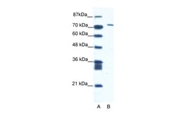 Aviva Systems Biology Corp CXORF6 Antibody - N-terminal region (ARP34221_T100)