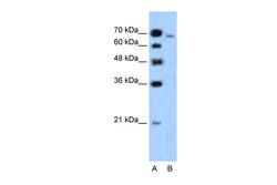 Aviva Systems Biology Corp AFDN Antibody - N-terminal region (ARP34225_T100)
