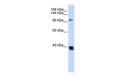 Aviva Systems Biology Corp HDAC4 Antibody - N-terminal region (ARP34229_P050)
