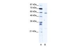 Aviva Systems Biology Corp PDLIM5 Antibody - middle region (ARP34273_T100)