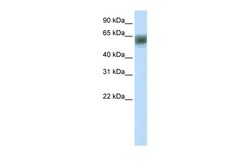 Aviva Systems Biology Corp ARID3B Antibody - N-terminal region (ARP34275_T100)