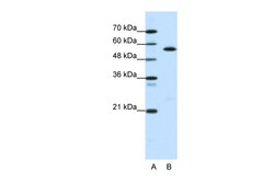 Aviva Systems Biology Corp CORO1A Antibody - middle region (ARP34286_P050)