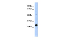 Aviva Systems Biology Corp CFAP20 Antibody - middle region (ARP34302_P050)