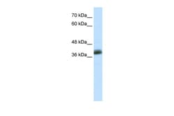 Aviva Systems Biology Corp SAP30BP Antibody - C-terminal region (ARP34303_P050)