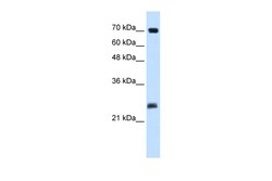 Aviva Systems Biology Corp SERTAD1 Antibody - N-terminal region (ARP34309_T100)