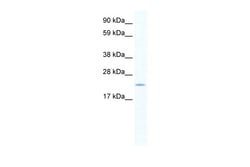 Aviva Systems Biology Corp SERTAD1 Antibody - N-terminal region (ARP34309_P050)