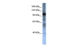 Aviva Systems Biology Corp SMARCAL1 Antibody - middle region (ARP34312_P050)