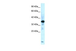 Aviva Systems Biology Corp ZFPL1 Antibody - middle region (ARP34354_P050)