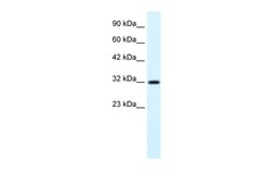 Aviva Systems Biology Corp COLQ Antibody - N-terminal region (ARP34362_P050)