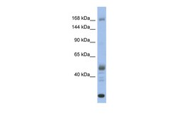 Aviva Systems Biology Corp CHD1 Antibody - middle region (ARP34368_P050)