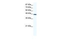 Aviva Systems Biology Corp ENO1 Antibody - C-terminal region (ARP34376_T100)