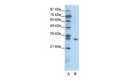 Aviva Systems Biology Corp NFKBIB Antibody - N-terminal region (ARP34382_P050)