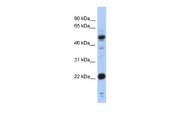 Aviva Systems Biology Corp CSRP1 Antibody - middle region (ARP34391_P050)
