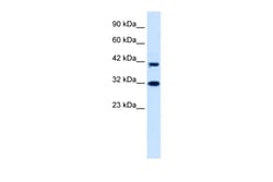 Aviva Systems Biology Corp DPF1 Antibody - middle region (ARP34397_P050)