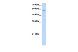 Aviva Systems Biology Corp ARIH2 Antibody - N-terminal region (ARP34418_T100)