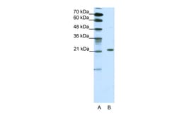 Aviva Systems Biology Corp CBX1 Antibody - middle region (ARP34427_T100)