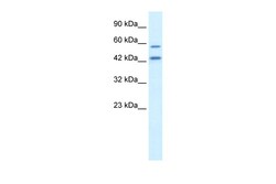 Aviva Systems Biology Corp APG4B Antibody - C-terminal region (ARP34434_P050)