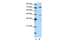 Aviva Systems Biology Corp ATG4B Antibody - C-terminal region (ARP34434_T100)
