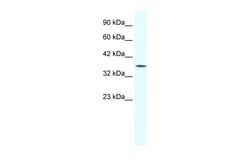 Aviva Systems Biology Corp YBX2 Antibody - middle region (ARP34450_T100)