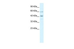 Aviva Systems Biology Corp TRIM68 Antibody - middle region (ARP34461_P050)