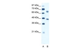 Aviva Systems Biology Corp RRN3 Antibody - middle region (ARP34463_T100)