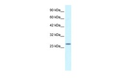 Aviva Systems Biology Corp ZA20D3 Antibody - middle region (ARP34464_T100)