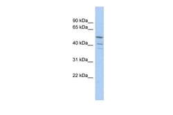 Aviva Systems Biology Corp TRIM50 Antibody - middle region (ARP34495_P050)
