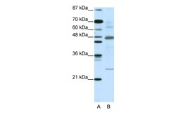 Aviva Systems Biology Corp NFKBIB Antibody - C-terminal region (ARP34504_T100)