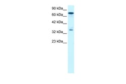 Aviva Systems Biology Corp NFKBIB Antibody - N-terminal region (ARP34505_T100)