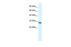 Aviva Systems Biology Corp FHL2 Antibody - C-terminal region (ARP34506_T100)